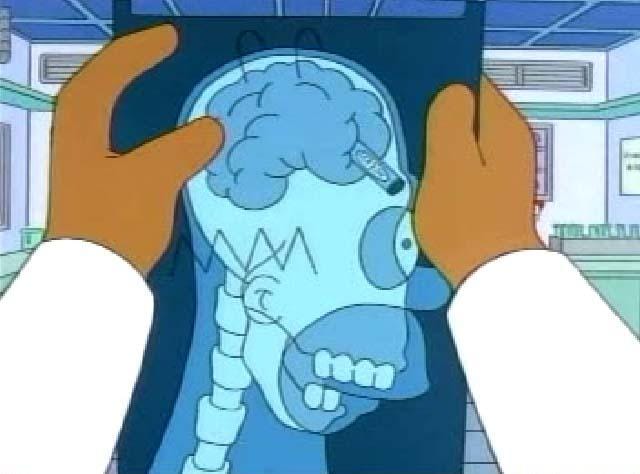 Homer with a crayon lodge in his brain